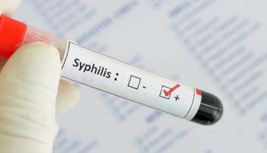 Casos de Sífilis aumentam 5.000% e doença volta a ser epidemia